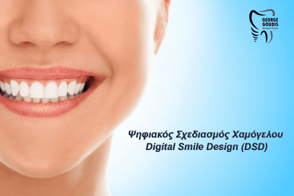 Ψηφιακός Σχεδιασμός Χαμόγελου - Digital Smile Design (DSD)