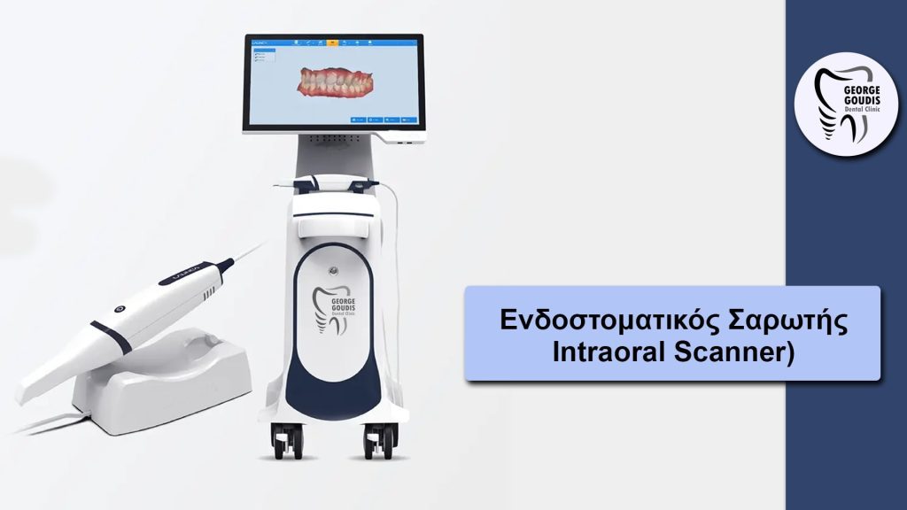 ενδοστοματικό scanner τι είναι και τι προσφέρει