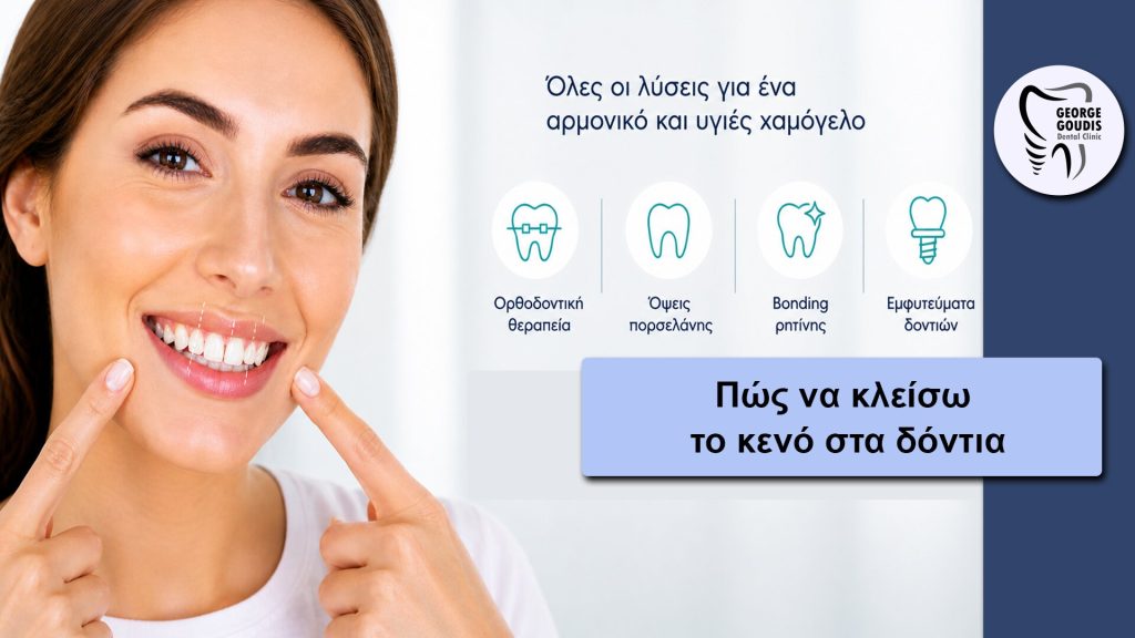Πώς να κλείσω το κενό στα δόντια